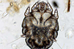 Chesoccal tick - insect cruising pod skórą