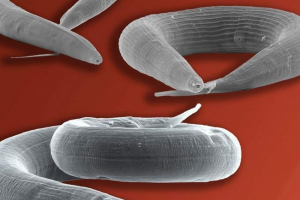 Pleśń człowieka Pleśń człowieka